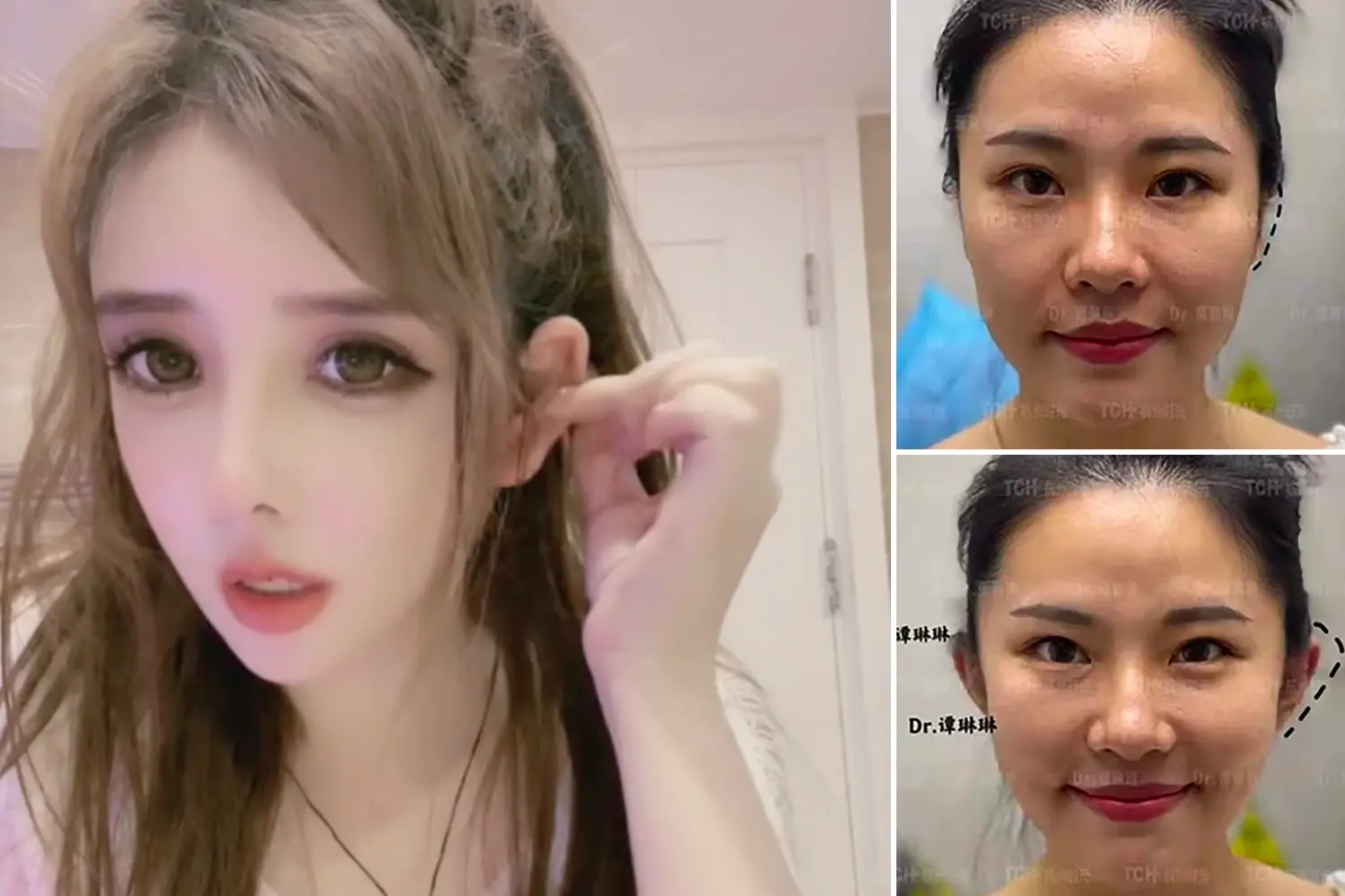 Asian plastic surgeries – out of control